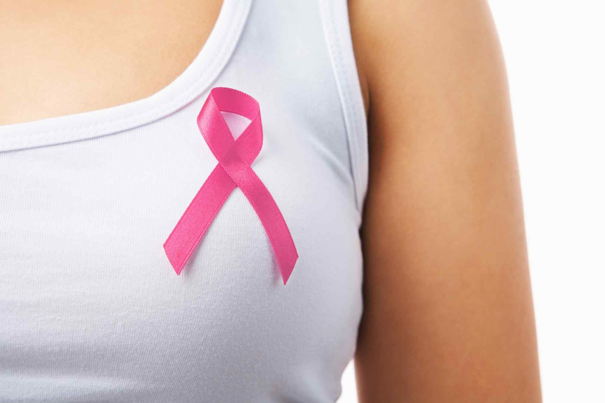 Study suggests breast density alone not a risk factor for cancer